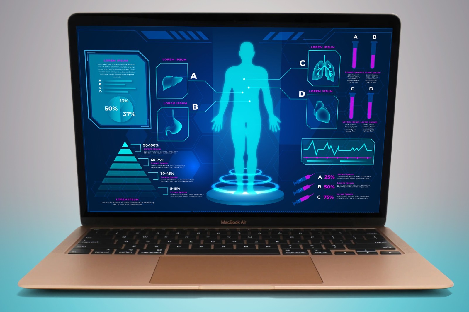 Sequoia NEW OS 2020-21+ Apple MacBook Air 13″ M1 8GB RAM 128GB SSD – WARRANTY