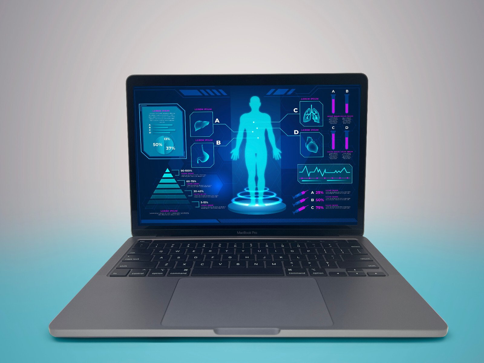 TAHOE NEW OS 2020-21+ Apple MacBook Pro 13″ M1 8GB RAM 512GB SSD – WARRANTY